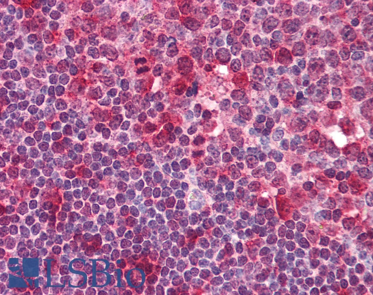 IHC-plus™ SYK Antibody (aa5-360, clone SYK-01)