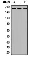Polyclonal Rabbit anti-Human IRS1 Antibody (phospho-Ser636, IHC, IF, WB)