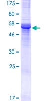 Human PHYHIP Protein (Recombinant GST)