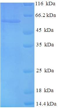 Human TP53 / p53 Protein (Recombinant His-SUMO)