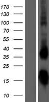 Human TSHB / TSH-Beta Protein (Over-Expression Lysate Myc-DDK (Flag))