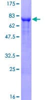 Human CD66a / CEACAM1 Protein (Recombinant GST)