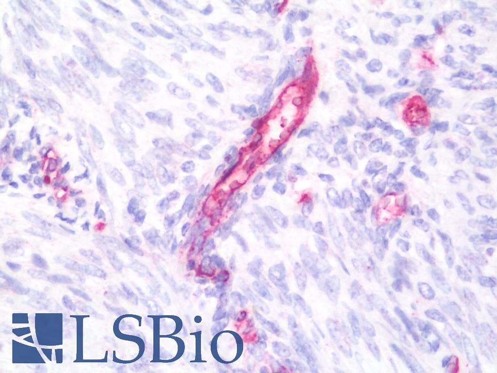 IHC-plus™ ATP5D Antibody