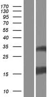 Human ESM1 / Endocan Protein (Over-Expression Lysate Myc-DDK (Flag))