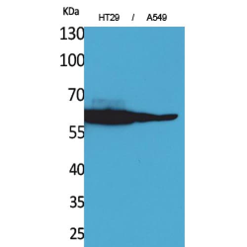CAT / Catalase Antibody (C-terminal)