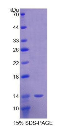 Mouse SEMA3E / Semaphorin 3E Protein (Recombinant His)