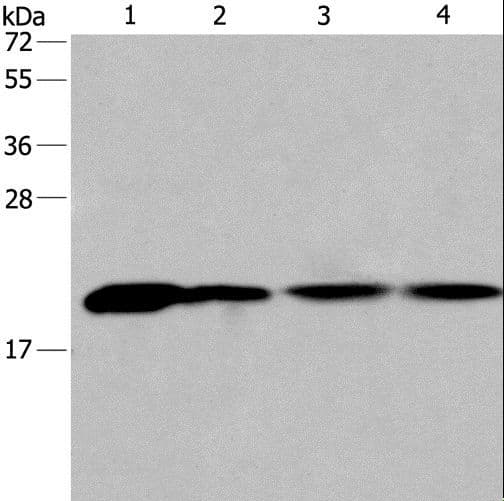 Polyclonal Rabbit anti-Human PPIB / Cyclophilin B Antibody (IHC, WB)