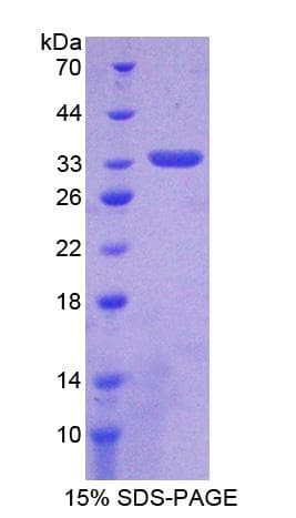 Rat PDGF-D Protein (Recombinant His, N-Terminal)