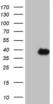Monoclonal Mouse anti-Human KLK8 / Kallikrein 8 Antibody (clone OTI3A12, aa33-260, WB)
