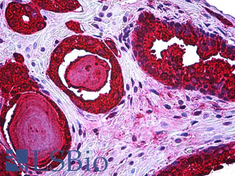 PathPlus™ Monoclonal Mouse anti-Human KLK3 / PSA Antibody (IHC)