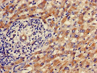 ALDH9A1 Antibody