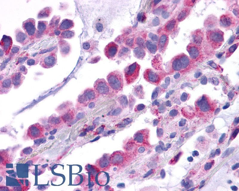 PathPlus™ Polyclonal Rabbit anti-Human TACR1 / NK1R Antibody (Extracellular Domain, IHC)
