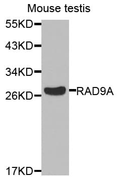 Polyclonal Rabbit anti-Human RAD9A / RAD9 Antibody (IHC, IF, WB)