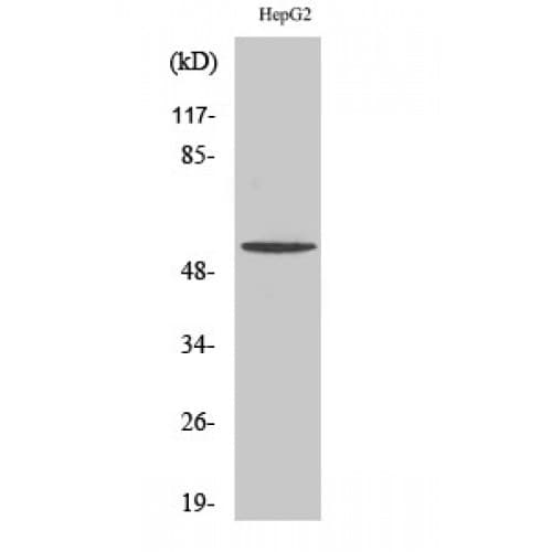TMEM145 Antibody (30-110 aa, Internal)