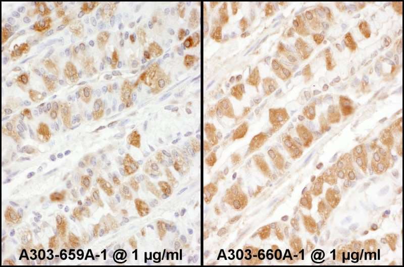 Polyclonal Rabbit anti-Human PKM / Pyruvate Kinase, Muscle Antibody (aa1-50, IHC, WB)