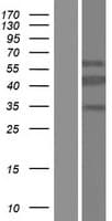 Human CT47A11 Protein (Over-Expression Lysate Myc-DDK (Flag))