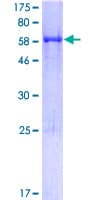 Human Apolipoprotein A-V (Recombinant GST)