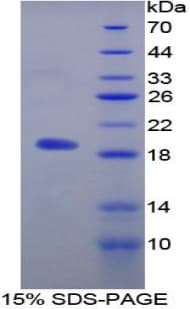 Rat MFAP5 / MAGP2 Protein (Recombinant His-T7)