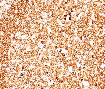 CD79A / CD79 Alpha Antibody (aa202-216, clone JCB117 + HM47/A9, Ready-to-Use)