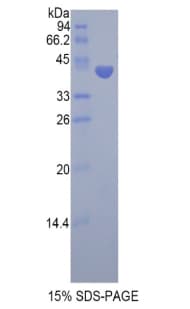 Pig FSHB / FSH Beta Protein (Recombinant His-GST)