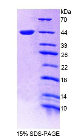 Human NR1D1 Protein (Recombinant His-T7, N-terminus)