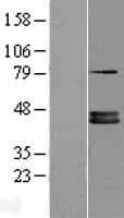 FDPS Protein (Over-Expression Lysate Myc-DDK (Flag))
