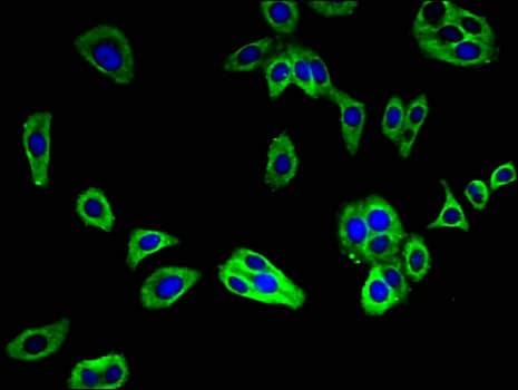 TMEM240 / C1orf70 Antibody
