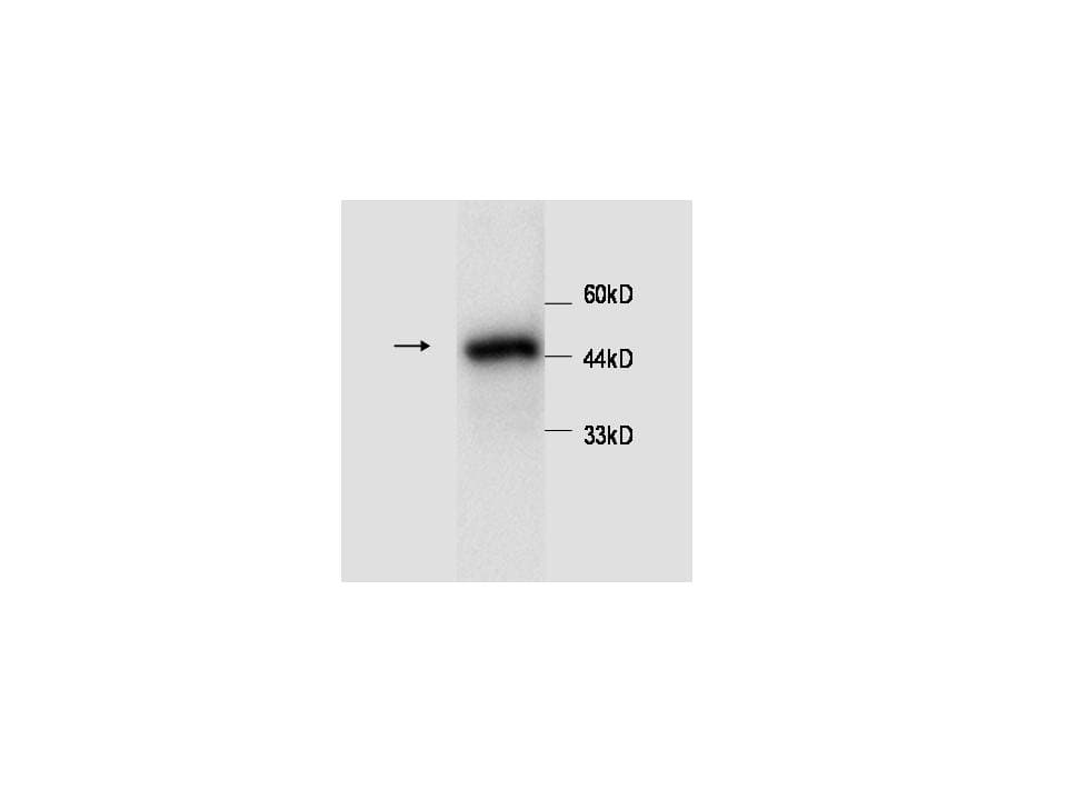 SERPINA1 / Alpha 1 Antitrypsin Antibody (aa25-418)