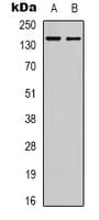 ADGRG6 / GPR126 Antibody (Internal)