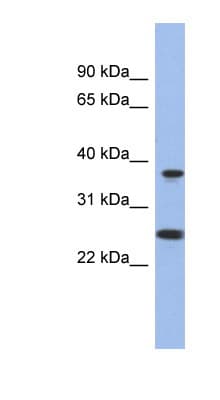 HMRF1L / MTRF1L Antibody (N-Terminus)