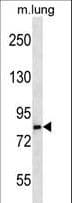 LRSAM1 Antibody (aa1-30)