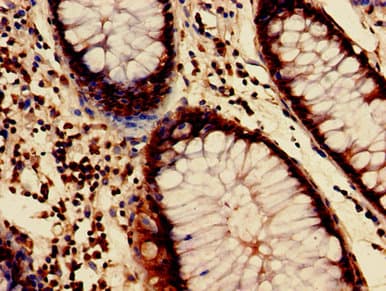 Polyclonal Rabbit anti-Human HIST1H3A Antibody (IHC, IF, WB)