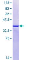 Human MUC16 / CA125 Protein (Recombinant GST, N-terminus)