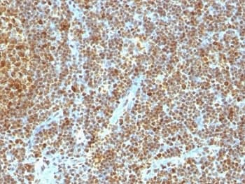 PCNA Antibody (clone SPM350)