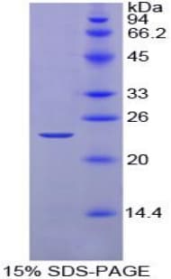 Chicken NOG / Noggin Protein (Recombinant His)