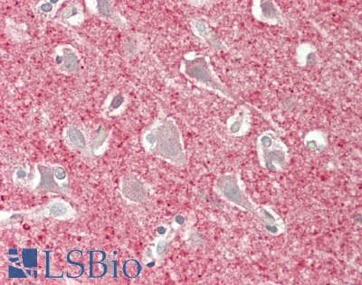 IHC-plus™ COL4A2 / Collagen IV Alpha2 Antibody (N-Terminus)