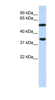 Polyclonal Rabbit anti-Human Complement C4b Antibody (aa144-193, WB)