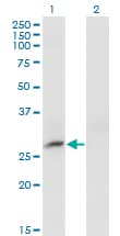 CRYBB3 Antibody (clone 4H6)