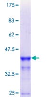 Human PLIN1 / Perilipin Protein (Recombinant GST, N-terminus)