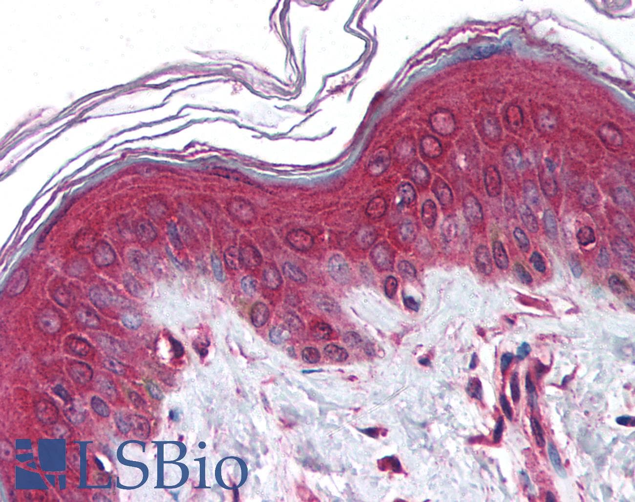 IHC-plus™ NCSTN / Nicastrin Antibody