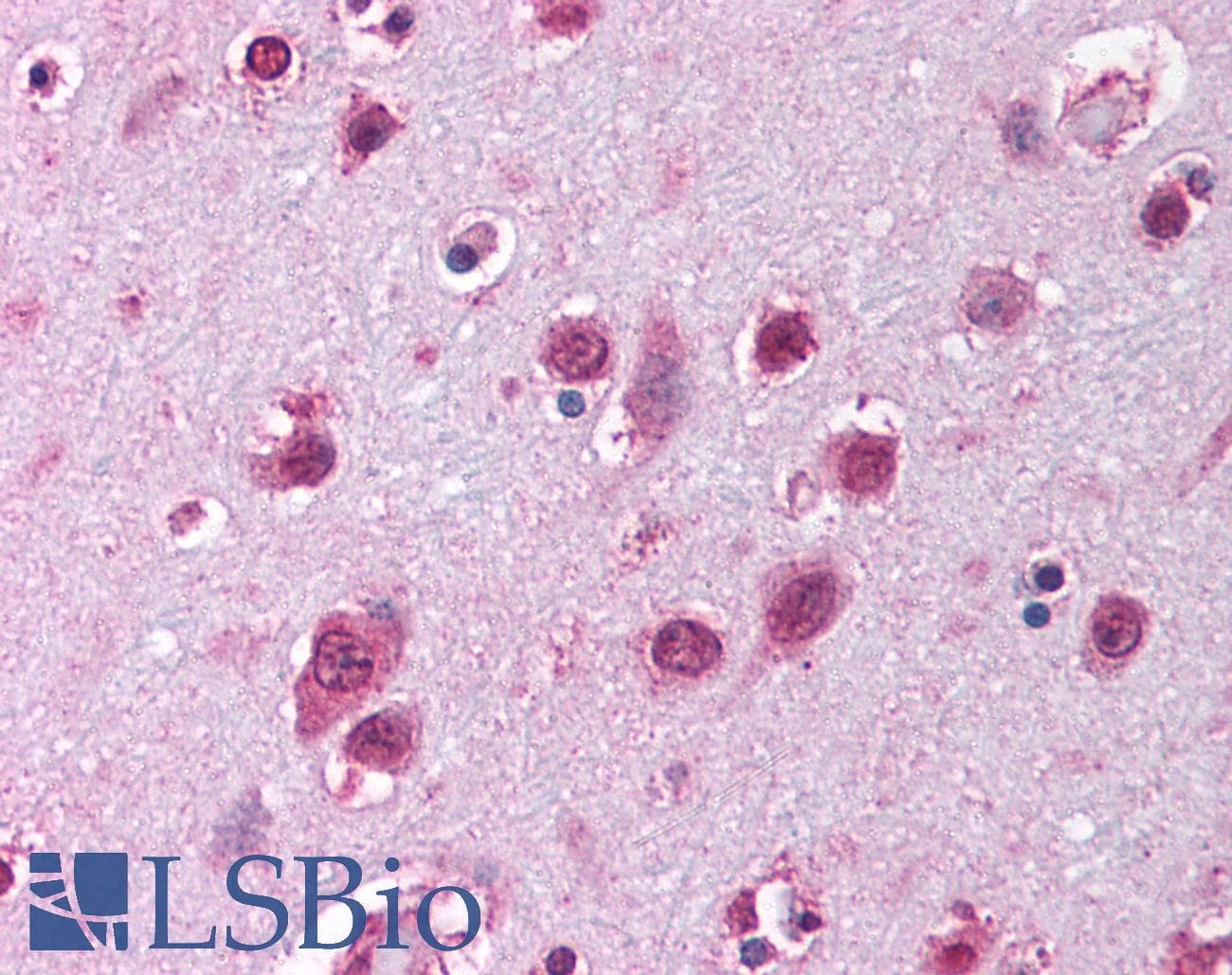 SOX12 Antibody (C-Terminus)