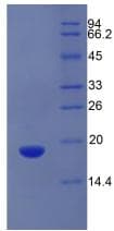 Mouse AZGP1 / ZAG Protein (Recombinant His, N-Terminal)