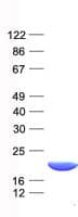 Human ARL2BP / BART Protein (Recombinant His, N-Terminal)