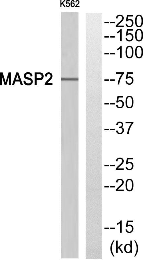 Polyclonal Rabbit anti-Human MASP2 / MASP-2 Antibody (WB)