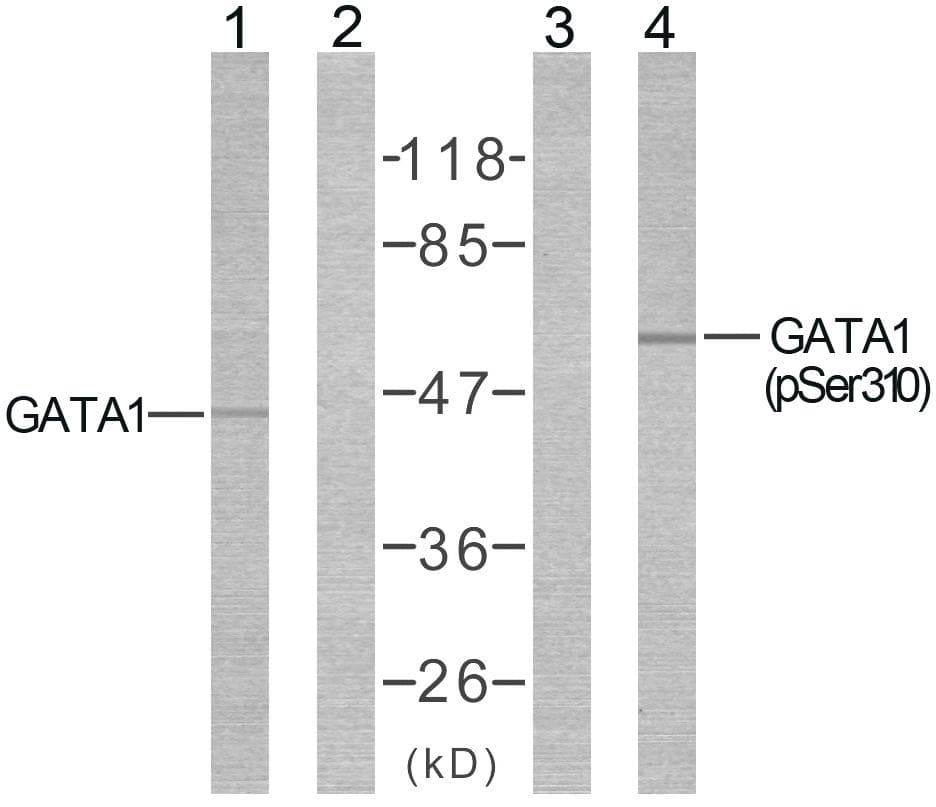 GATA1 Antibody (p310)