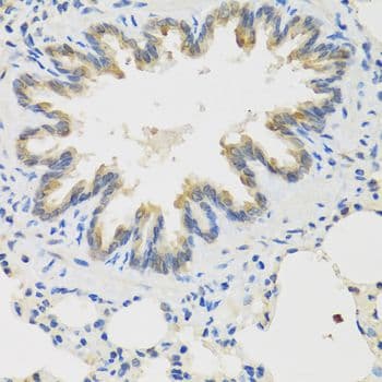 TICAM1 / TRIF Antibody