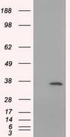 Monoclonal Mouse anti-Human SRR / Serine Racemase Antibody (clone OTI5G3, IHC, IF, WB)