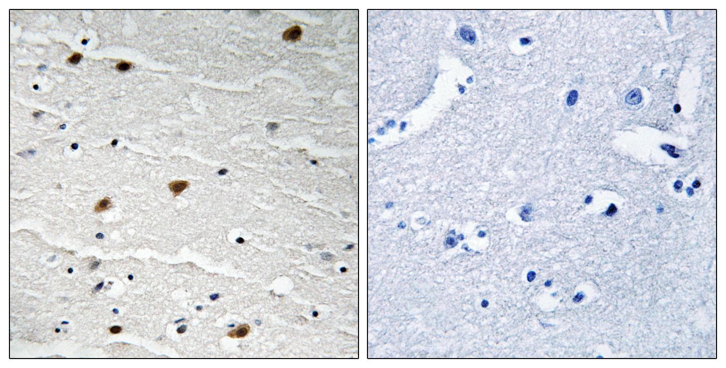 AKT1 + AKT2 + AKT3 Antibody (phospho-Tyr315/316/312)