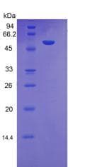 Rat KLK7 / Kallikrein 7 Protein (Recombinant His-GST)