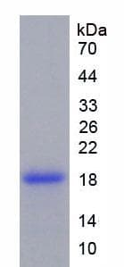Rat TNC / Tenascin C Protein (Recombinant His)